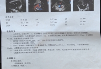 患者诊断结果